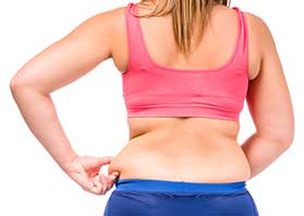 Lose Excess Fat in Palm Harbor, FL
